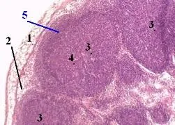 Peretele 13 al inimii (fibre Purkinje)