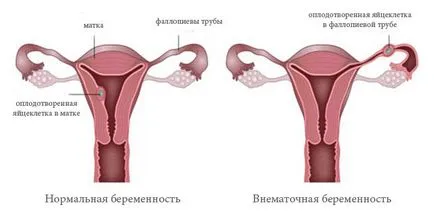 Основна температура по време на ранна бременност преди закъснението