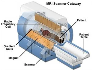 Mi MRI