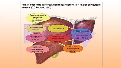 Care sunt simptomele de steatoză hepatică și tratamentul