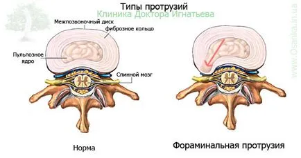 Какво е Infant