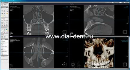 Digitális CT