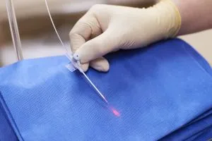 Endovasal (ендовенозни) лазер заличаване вени (evlo) отговори, по-специално процедури