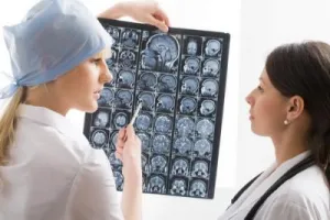 Epilepsia ce este semnele și tratamentul bolii