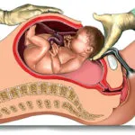Ginipral terhesség alkalmazási utasításokat, áttekintésre, ár és analógok