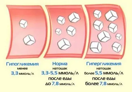 Éhgyomri vércukorszint diéta és megelőzésére a szénhidrát-anyagcsere