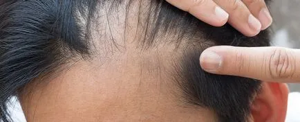 Imunitatea ajută părul să crească