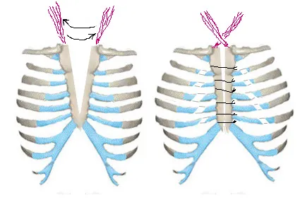 Какви видове стернотомия - функции и характеристики на работата, рехабилитация след