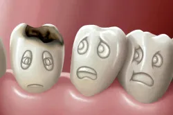Cum de a trata cariile între dinți