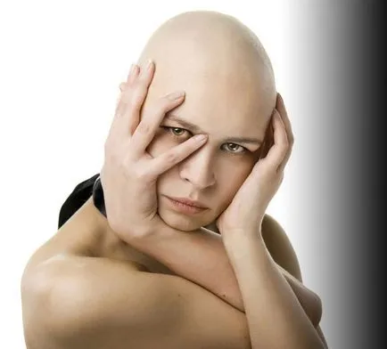 Alopecia areata cum să trateze