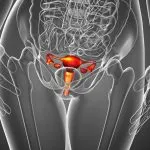 Chist ovarian simptome ale corpului galben, tratament, sarcina