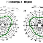 Компютърна периметрия око, дешифриране и цена