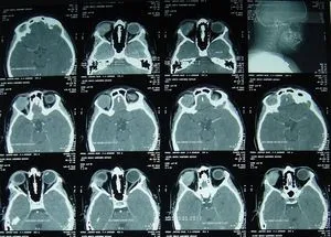 CT и MRI е разликата разлика от изследвания с прости думи