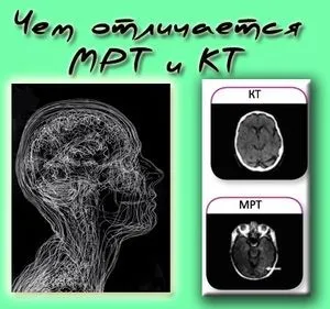 CT и MRI е разликата разлика от изследвания с прости думи