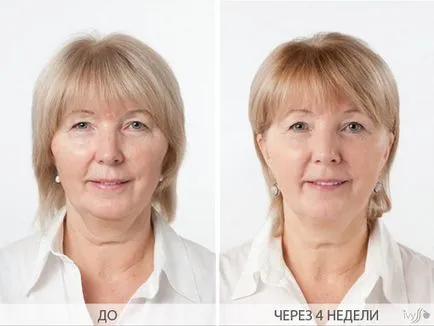 Krém anti-aging nap arc ivyss nap tökéletes gyógyírt - vásárolni, melynek ára 1499 rubel