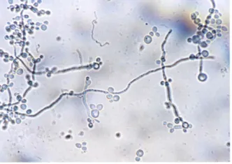 Laboratóriumi diagnosztikája onychomycosisban ebben a fejezetben nem írt a laboratóriumi személyzetet, valamint a