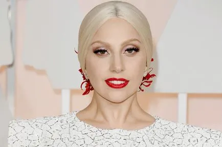 Lady gaga előtt és után plasztikai sebészet - 300