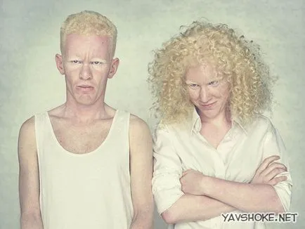 oameni Albino (foto)