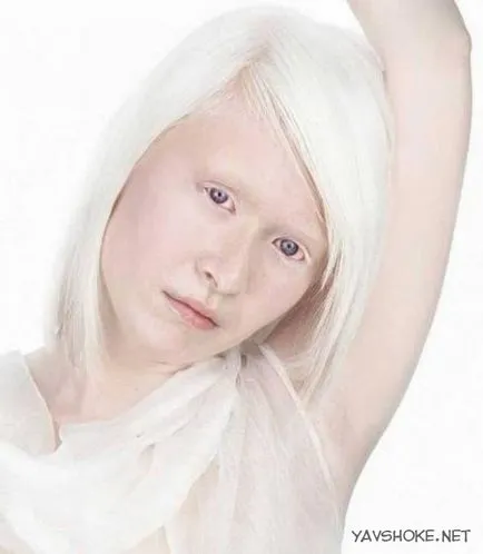 oameni Albino (foto)