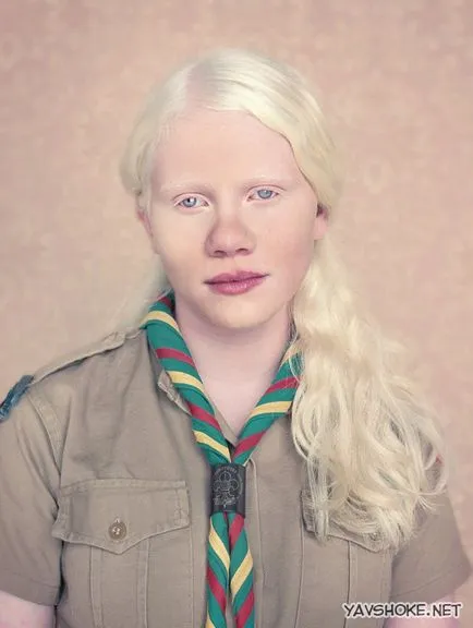 oameni Albino (foto)