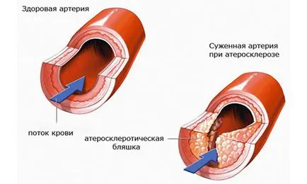 Майка и мащехата Кашлица правила за прилагане при лечението на растения