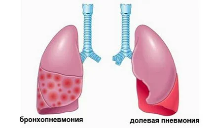 Normele mamei si tuse vitrega pentru aplicarea în tratamentul plantelor