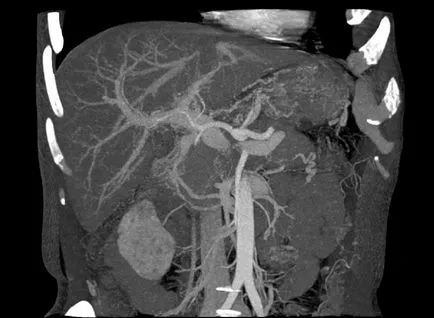 RMN-ul stomacului și esofagului prețurilor la Moscova tractului gastro-intestinal RMN, în cazul în care pentru a face o reducere