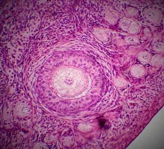 ovare normale pe ecografie (curs diagnostere)