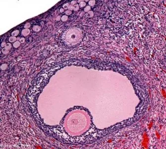 ovare normale pe ecografie (curs diagnostere)