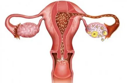 Normál petefészkek ultrahanggal (előadás diagnostere)