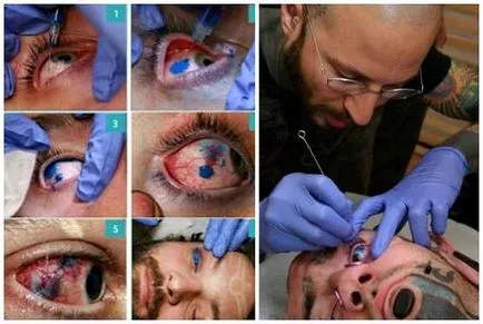 Tatuaj pe fotografii teribile glazah- de tatuaje pe globul ocular