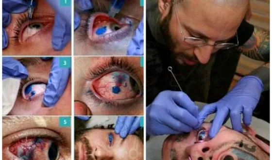 Tatuaj pe fotografii teribile glazah- de tatuaje pe globul ocular