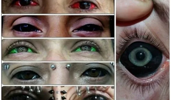 Tatuaj pe fotografii teribile glazah- de tatuaje pe globul ocular