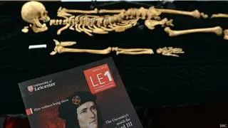 Oamenii de știință au dat seama cum să Richard Iii regele a fost ucis - bbc Serviciul rus