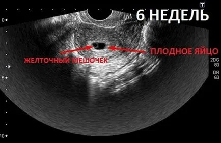 Uzi 6 săptămâni de sarcină obstetrică, care arată