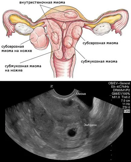 Uzi 6 săptămâni de sarcină obstetrică, care arată