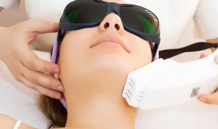 Rece, cojile cald cu laser - comentarii, preț, efect, de îngrijire după peeling