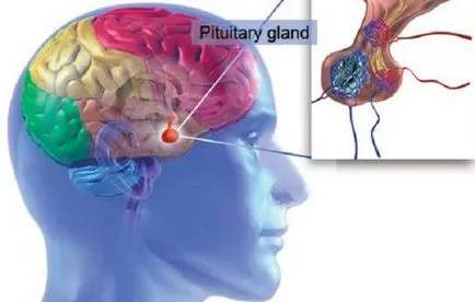 hypophysis betegség okoz, a tünetek, a kezelés