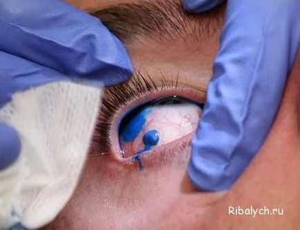 Ужасно процедура - татуировка на очите