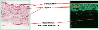 кожни диагностика Ултразвукова диагностика неинвазивна диагностика на кожата, апарати и инструменти за