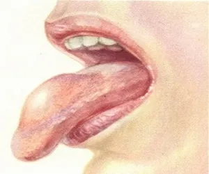 hemangiom limba