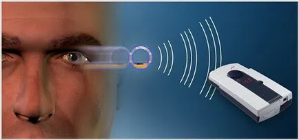 implanturi oftalmice - o privire de ansamblu asupra livemd