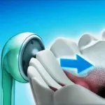 Dusul bucal oral