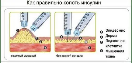 В дългосрочен и краткосрочен на инсулин, което е по-добре и как да изберем