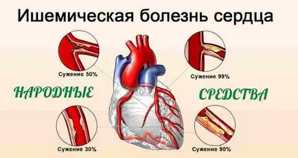 Tratamentul eficient al remedii populare cardiace