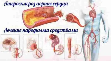 Tratamentul eficient al remedii populare cardiace