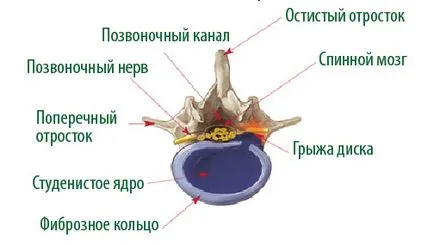 лечение херния, регионалния медицински център