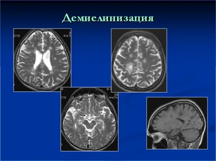 Brain MRI - Министерството на CT и MRI SRI КН тях