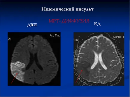 Brain MRI - Министерството на CT и MRI SRI КН тях