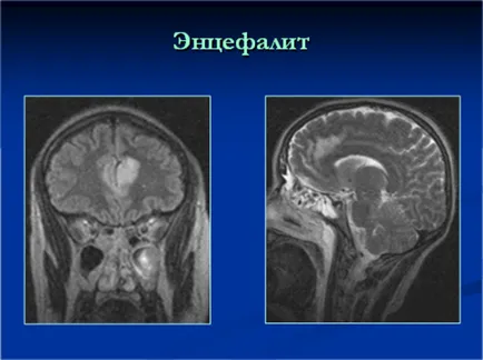 Brain RMN - Departamentul de CT si RMN SRI cn le